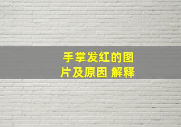 手掌发红的图片及原因 解释